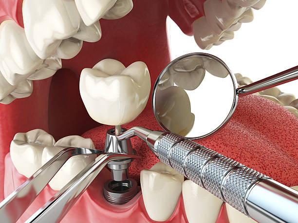 Best Emergency Treatment for Jaw Pain or Injury in Galt, CA